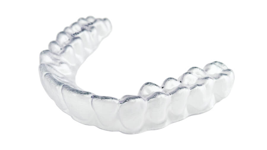 ClearCorrect Aligner – transparente Zahnschiene